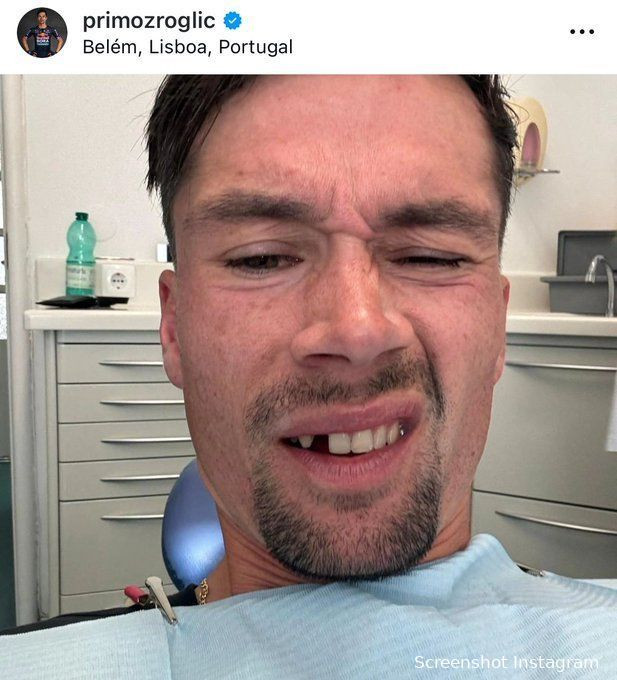 girodociclismo.com.br primoz roglic sofre emergencia dentaria na vespera da largada da vuelta apesar disso o esloveno nao perdeu o humor image