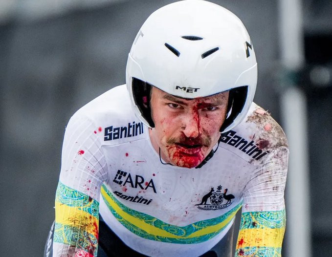 Ciclista da UAE Team Emirates sofre forte queda no Mundial e revela frustração "é de partir o coração pensar o que poderia ter sido" 3 girodociclismo.com.br ciclista da uae team emirates sofre forte queda no mundial e revela frustracao e de partir o coracao pensar o que poderia ter sido image 2