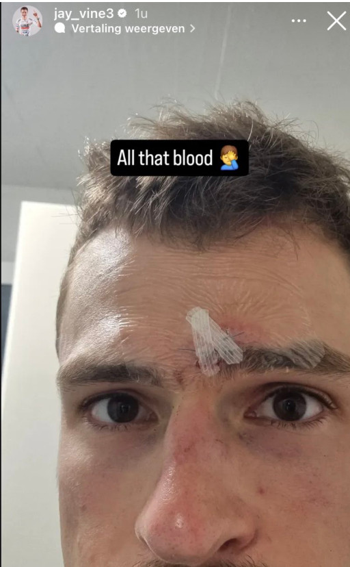 Ciclista da UAE Team Emirates sofre forte queda no Mundial e revela frustração "é de partir o coração pensar o que poderia ter sido" 4 girodociclismo.com.br ciclista da uae team emirates sofre forte queda no mundial e revela frustracao e de partir o coracao pensar o que poderia ter sido image 5