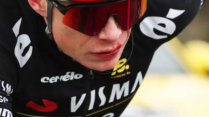 girodociclismo.com.br jonas vingegaard nao se recupera e esta fora da volta a catalunya confira o anuncio oficial da visma lease a bike image