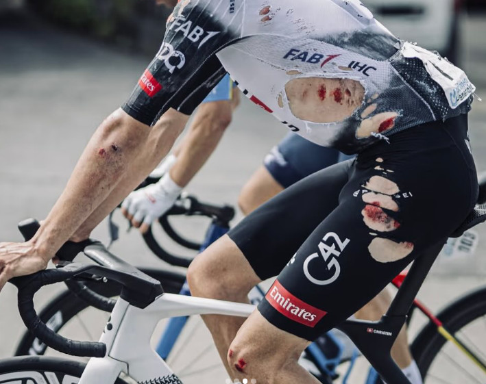 UAE Emirates revela motivo do abandono do gregário de João Almeida, equipe justifica através das redes sociais; confira o anúncio oficial 2 girodociclismo.com.br uae emirates revela causa do abandono do gregario de joao almeida no tour de suisse equipe justifica atraves das redes sociais image