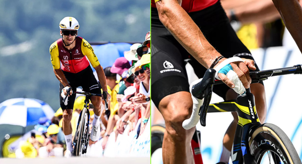 Bryan Coquard sofre fratura na mão e abandona o Tour de France "por questões de segurança, não posso largar no sábado", confira o anúncio oficial 1 girodociclismo.com.br bryan coquard abandona o tour de france apos fratura na mao image