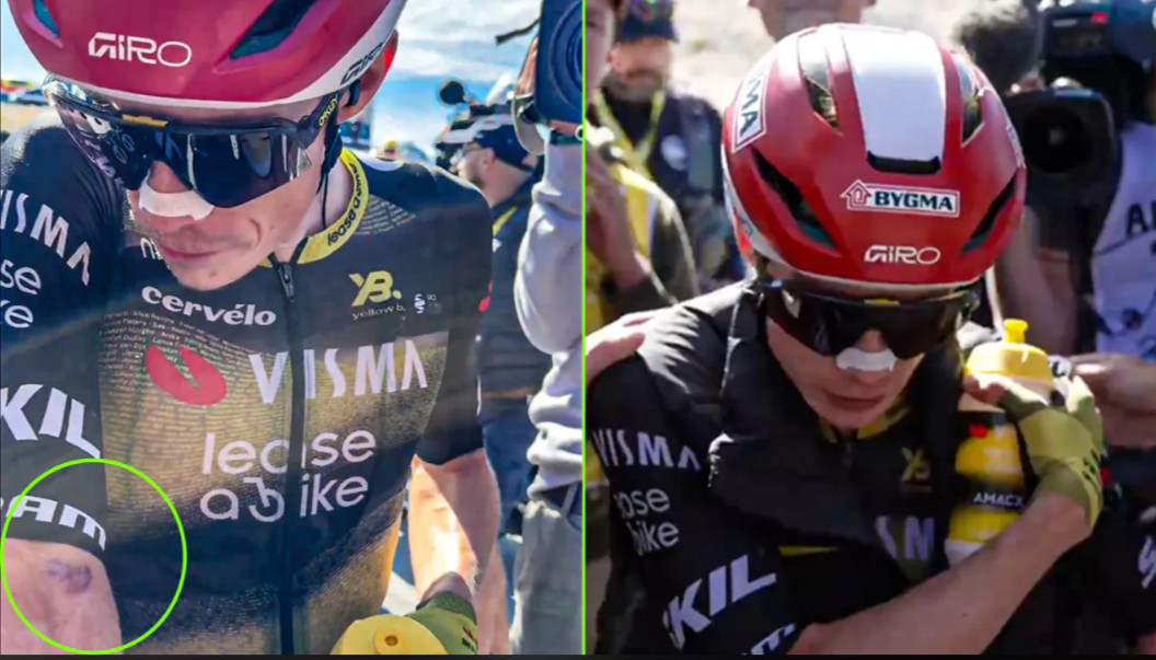 Jonas Vingegaard sofre queda após a chegada no Mont Ventoux e reclama de dores no ombro "não sei o que ele estava fazendo"; assista o vídeo 1 girodociclismo.com.br tour de france 2025 jonas vingegaard sofre acidente apos a chegada e reclama de dores no ombro image
