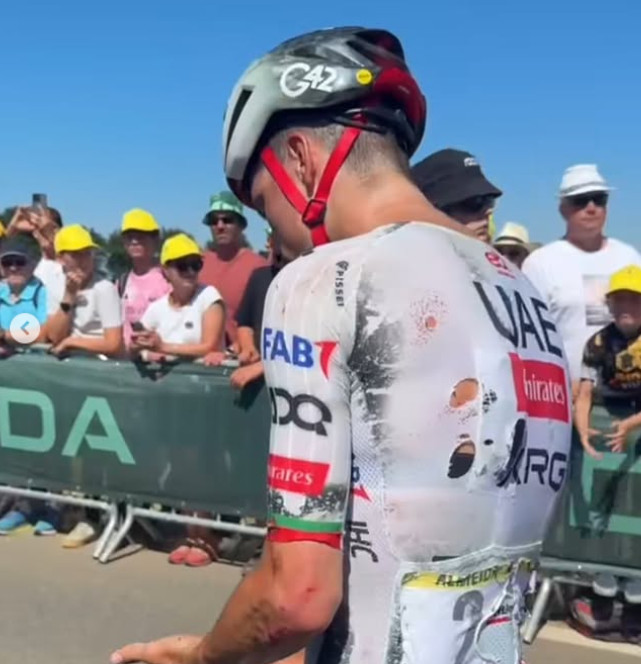girodociclismo.com.br uae emirates atualiza situacao de joao almeida apos grave queda no tour tenho uma costela levemente fraturada mas devo comecar amanha afirmou o portugues image