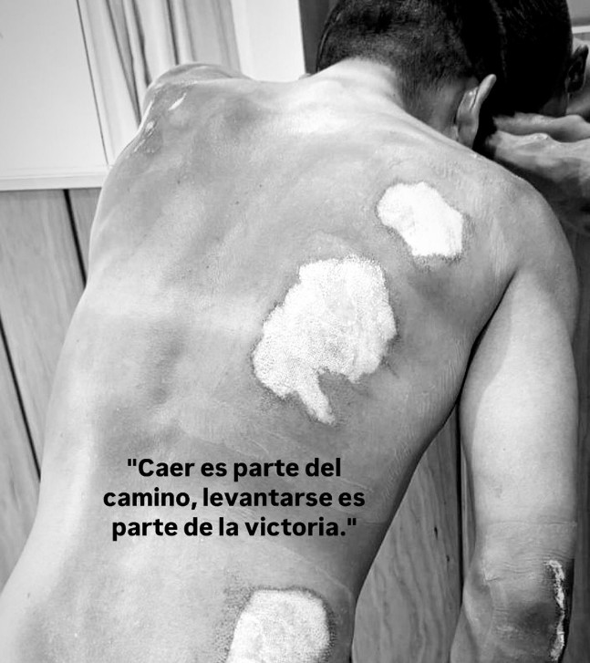Nairo Quintana fora da Vuelta a España 2025, Movistar anuncia que principal sprinter também não participará 2 girodociclismo.com.br nairo quintana esta fora da vuelta a espana 2025 movistar anuncia que principal sprinter tambem esta fora image