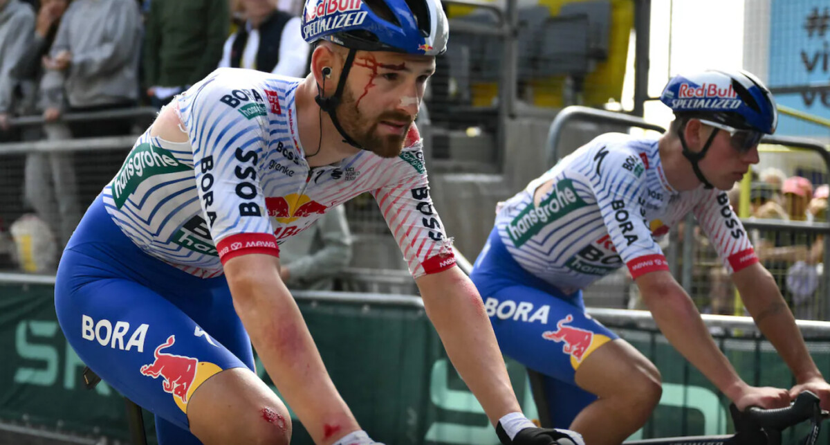 "Passo duas horas por dia tratando as feridas" sprinter da Red Bull Bora luta contra ferimentos após queda no Tour de France 2 girodociclismo.com.br passo duas horas por dia tratando as feridas sprinter da red bull bora ainda luta contra ferimentos apos queda no tour de france image 9