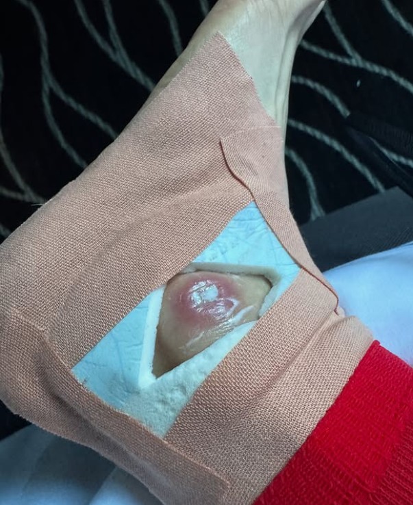 girodociclismo.com.br pauline ferrand prevot sofre cirurgia no tornozelo campea do tour de france enfrenta recuperacao durante as ferias image 4