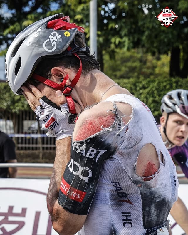 girodociclismo.com.br uae emirates atualiza situacao de rui oliveira portugues estava na grave queda do tour de guangxi assista o video image