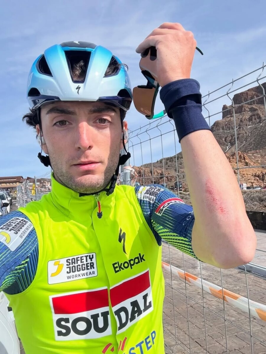 girodociclismo.com.br ciclista da soudal quick step revela drama apos ser atropelado ele fugiu como se minha vida nao valesse nada confira as imagens image 1