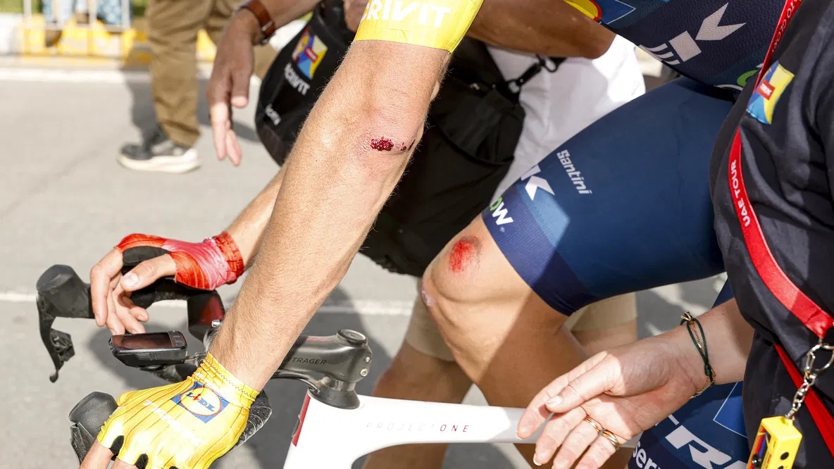 girodociclismo.com.br lidl trek atualiza situacao de jonathan milan apos forte queda no uae tour image 2