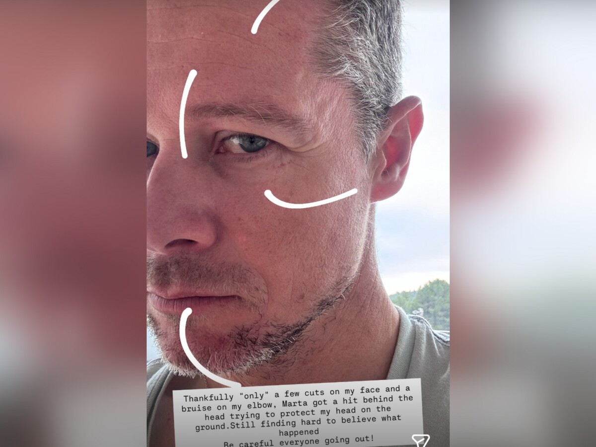 girodociclismo.com.br vencedor de etapa da vuelta a espana e brutalmente agredido em barcelona image 4