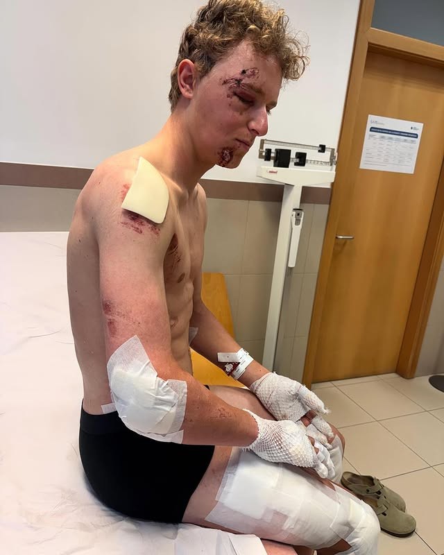girodociclismo.com.br ciclista da lidl trek sofre grave acidente image 1