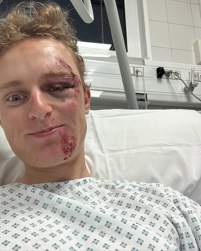girodociclismo.com.br ciclista da lidl trek sofre grave acidente image