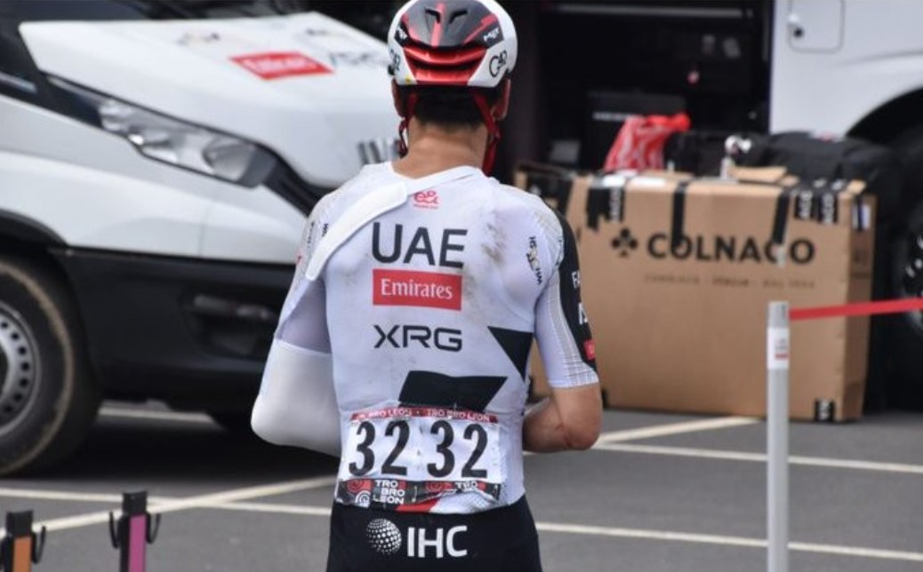 girodociclismo.com.br uae team emirates xrg sofre novo reves com lesao de filippo baroncini image 1