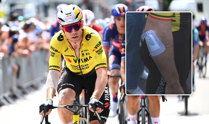 Wout van Aert pode ficar fora o Tour de France devido ao agravamento da lesão "ele já estava 'abaixo do nível esperado'" afirma diretor 2 girodociclismo.com.br wout van aert pode ficar fora do tour de france devido ao agravamento da lesao apos queda image 2
