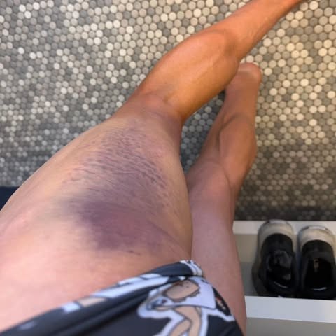 Primoz Roglic é atropelado durante treino e está fora de importantes competições, confira o anúncio do esloveno 2 girodociclismo.com.br primoz roglic e atropelado durante treino e fica fora das provas de san sebastian e burgos image 1