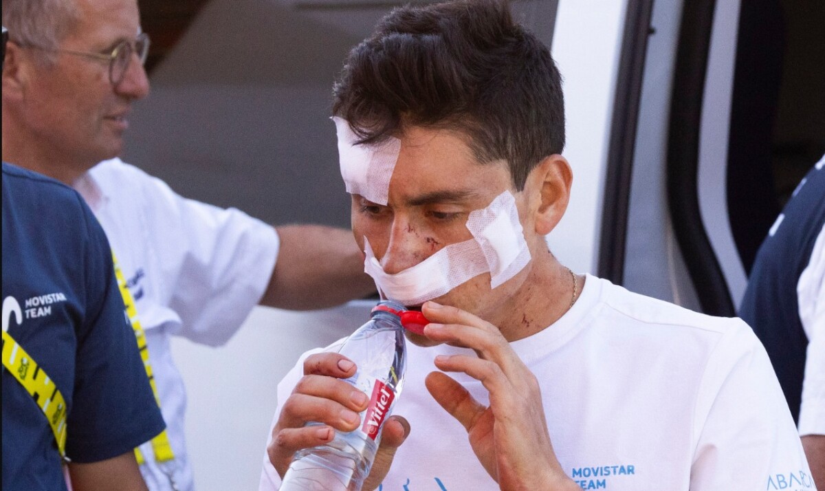 girodociclismo.com.br tour de france ciclista sofre grave acidente ao chocar se com carro da uae emirates atleta abandona apos receber 20 pontos no rosto assista os videos image 1