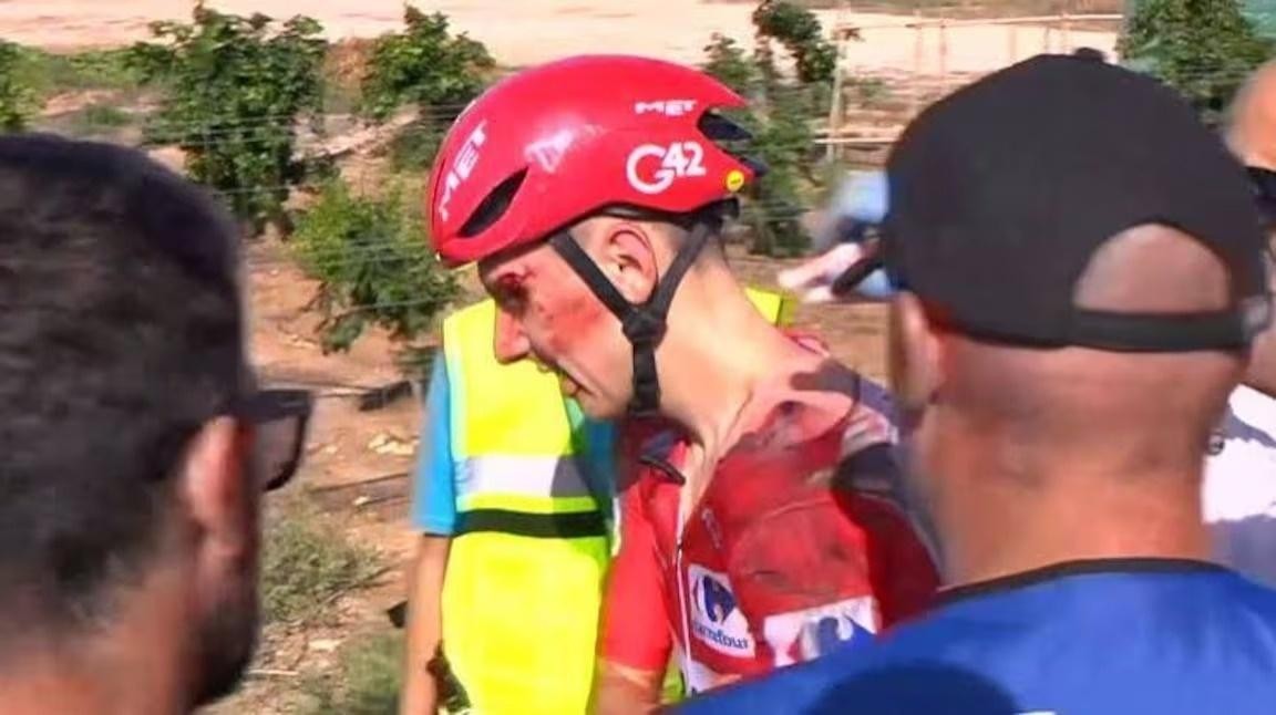 girodociclismo.com.br uae emirates atualiza situacao de tadej pogacar e final da temporada esta ameacada a fratura e bem seria assista o video image 1