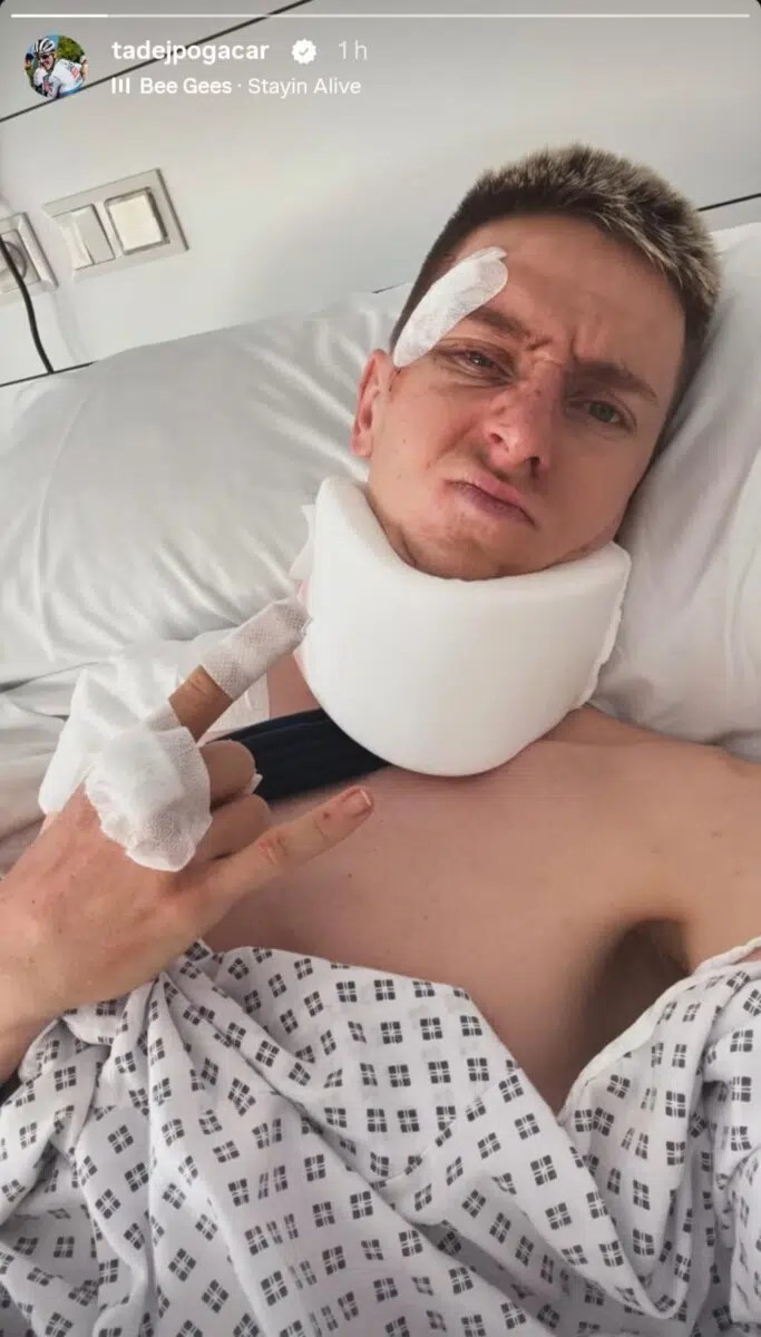 girodociclismo.com.br uae emirates atualiza situacao de tadej pogacar e final da temporada esta ameacada a fratura e bem seria assista o video image 3