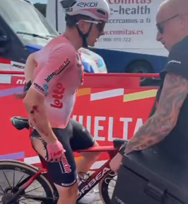 girodociclismo.com.br vuelta a espana 2026 ciclista do world tour sofre graves lesoes apos queda e abandona a competicao assista o video image 7
