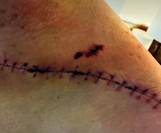 girodociclismo.com.br tadej pogacar atualiza sua situacao apos grave queda compartilha video em seu 1o treino assista as imagens image 4