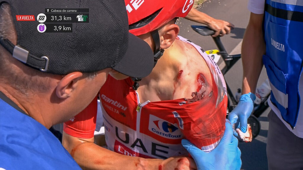 girodociclismo.com.br tadej pogacar podera estar na il lombardia nao no mundial diretor de lenda do ciclismo fala sobre lesoes de pogacar assista o video image 7